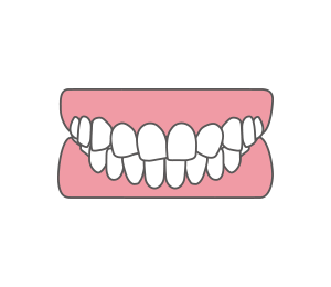 歯の位置異常